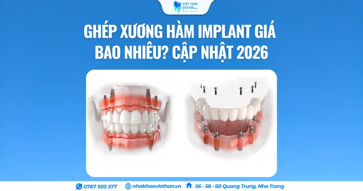 Chụp X-quang răng có an toàn không? Những điều quan trọng cần biết