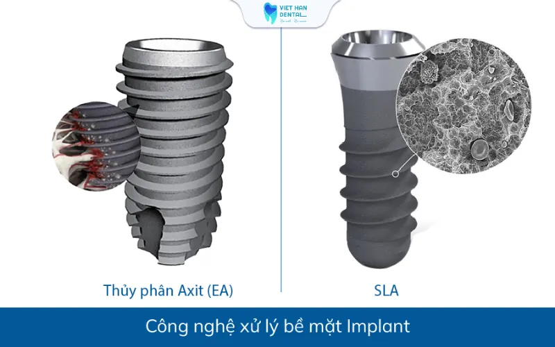 Công nghệ xử lý bề mặt trụ Implant