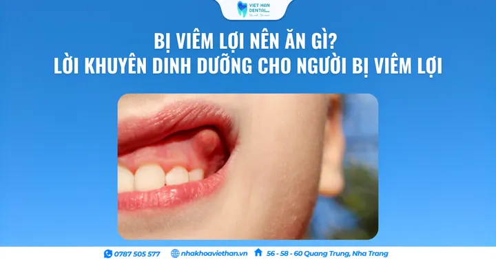Bị Viêm Lợi Nên Ăn Gì? Lời Khuyên Dinh Dưỡng Cho Người Bị Viêm Lợi