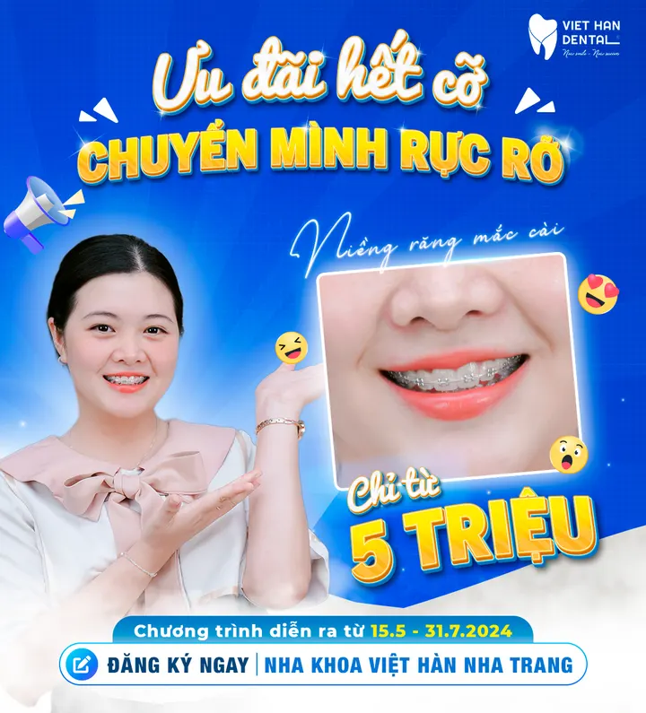 Niềng răng mắc cài chỉ từ 5.000.000đ – Ưu đãi đặc biệt mùa hè!