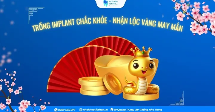 TRỒNG IMPLANT CHẮC KHỎE – NHẬN LỘC VÀNG MAY MẮN!
