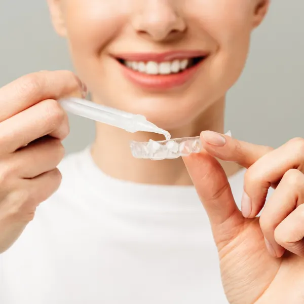 Tẩy trắng tại nhà bằng máng