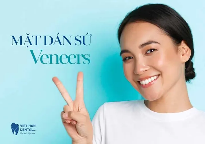 Mặt dán sứ Veneer