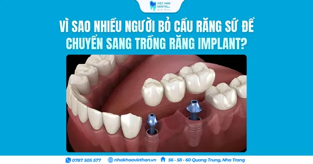 Từ cầu răng sứ đến lựa chọn Implant bền vững hơn