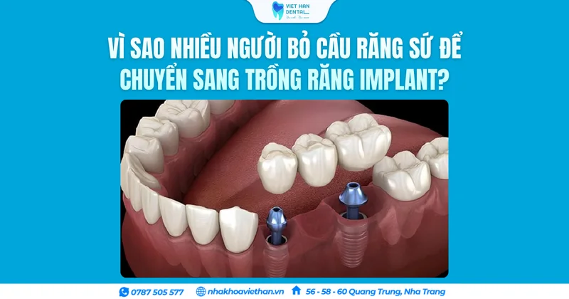 Từ cầu răng sứ đến lựa chọn Implant bền vững hơn