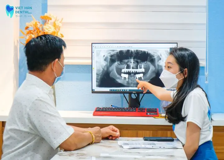 Nhakhoaviethancam-implant-co-dau-khong