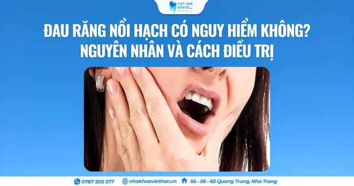 Đau răng nổi hạch có nguy hiểm không? Nguyên nhân và cách điều trị