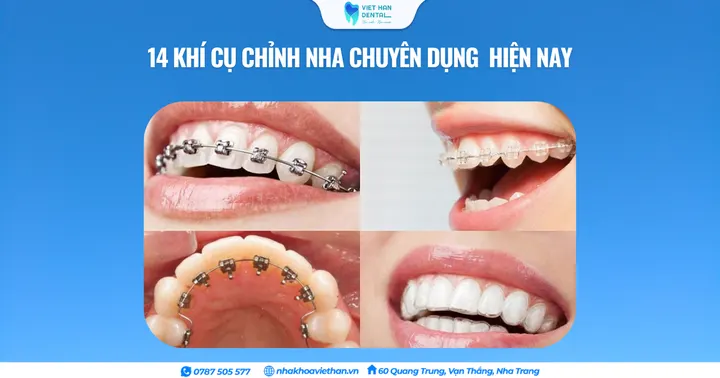 Top 14 khí cụ chỉnh nha chuyên dụng hiện nay