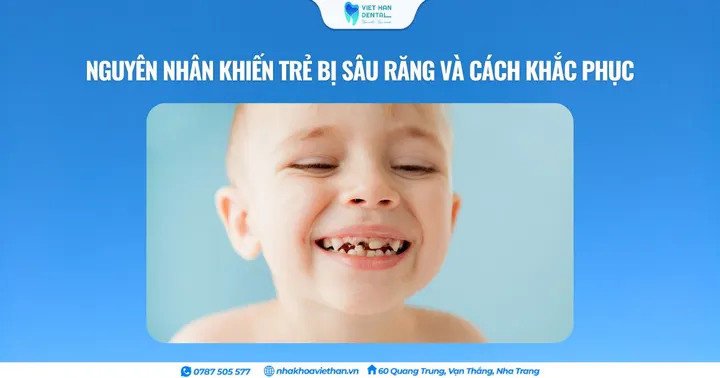 Nguyên nhân khiến trẻ bị sâu răng và cách khắc phục