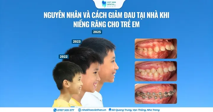 Nguyên nhân và cách giảm đau tại nhà khi niềng răng cho trẻ em