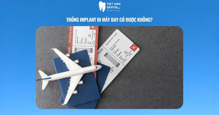 Trồng implant đi máy bay có được không?