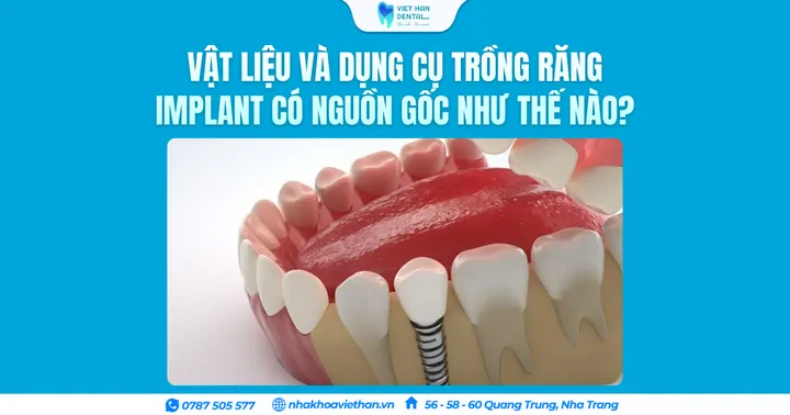 Vật liệu và dụng cụ trồng răng Implant có nguồn gốc như thế nào?