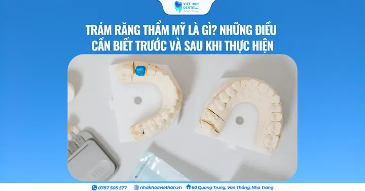 Trám răng thẩm mỹ là gì? Những điều cần biết trước và sau khi thực hiện