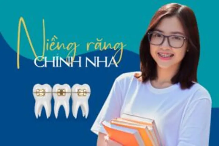 Niềng răng