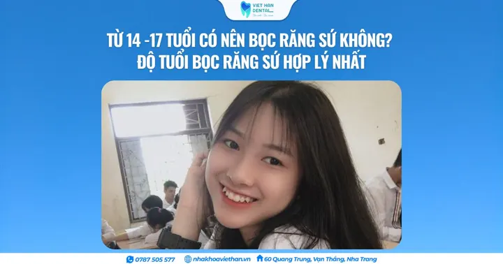 Từ 14 -17 tuổi có nên bọc răng sứ không? Độ tuổi bọc răng sứ hợp lý nhất