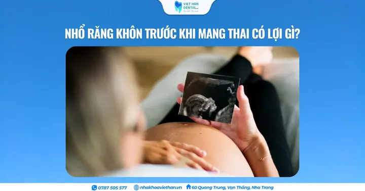 Nhổ răng khôn trước khi mang thai có lợi gì?