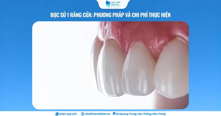 Bọc sứ 1 răng cửa: Phương pháp và chi phí thực hiện
